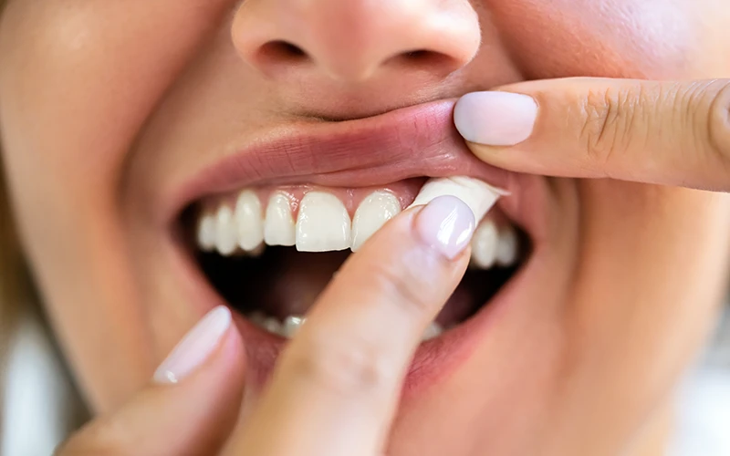 How Long Do ZYN and Other Nicotine Pouches Last - 1